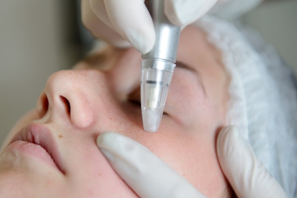 Microdermabrasion - Skin Therapies With Great Results
