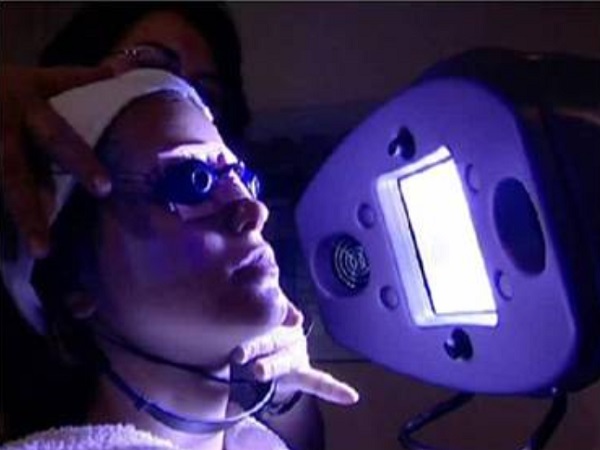 Acne Blue Light Therapy - Skin Therapies With Great Results