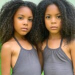 Ten Bizarre and Amazing Facts You Should Know About Twins